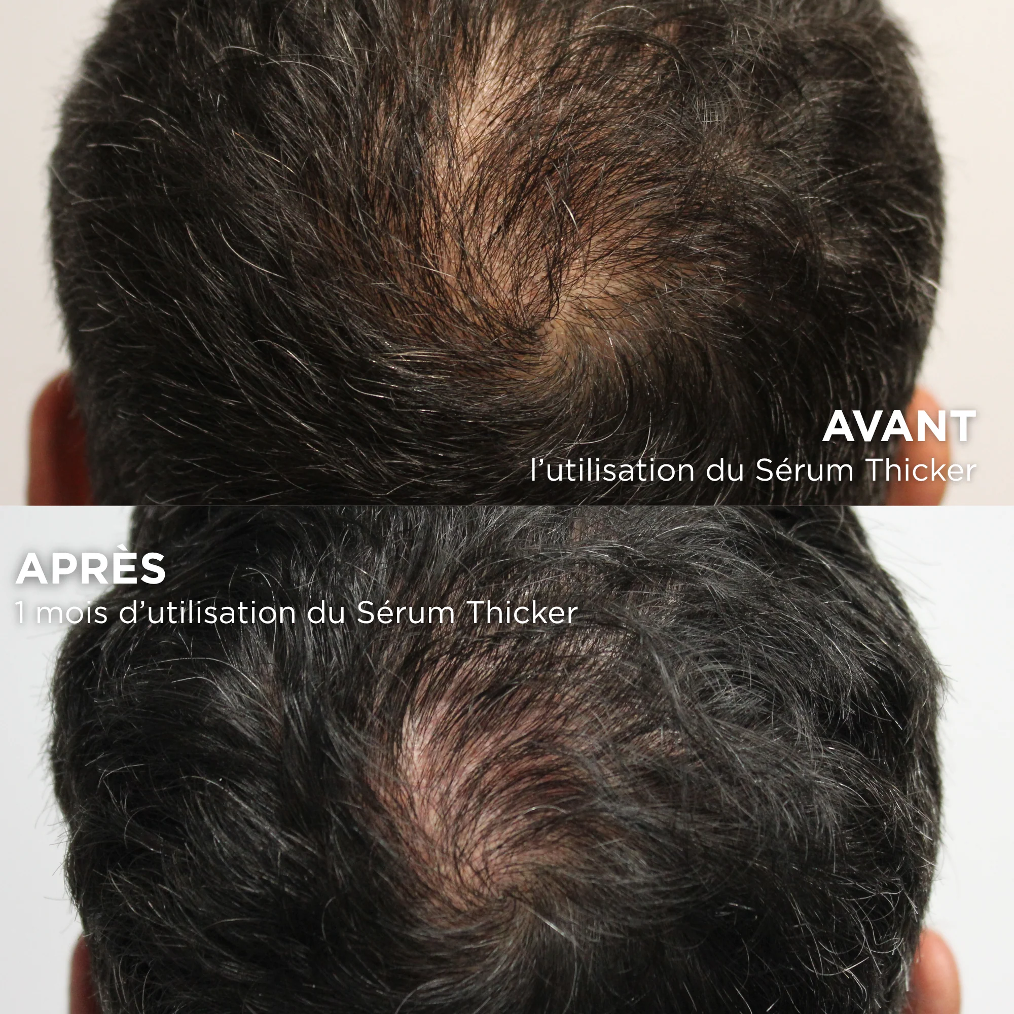 THICKER HAIR SERUM (Sérum anti-chute densifiant) - Image 3